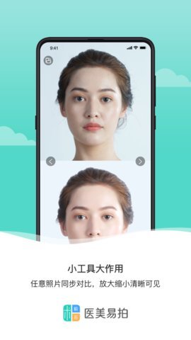 医美易拍最新版手机app下载-医美易拍无广告版下载