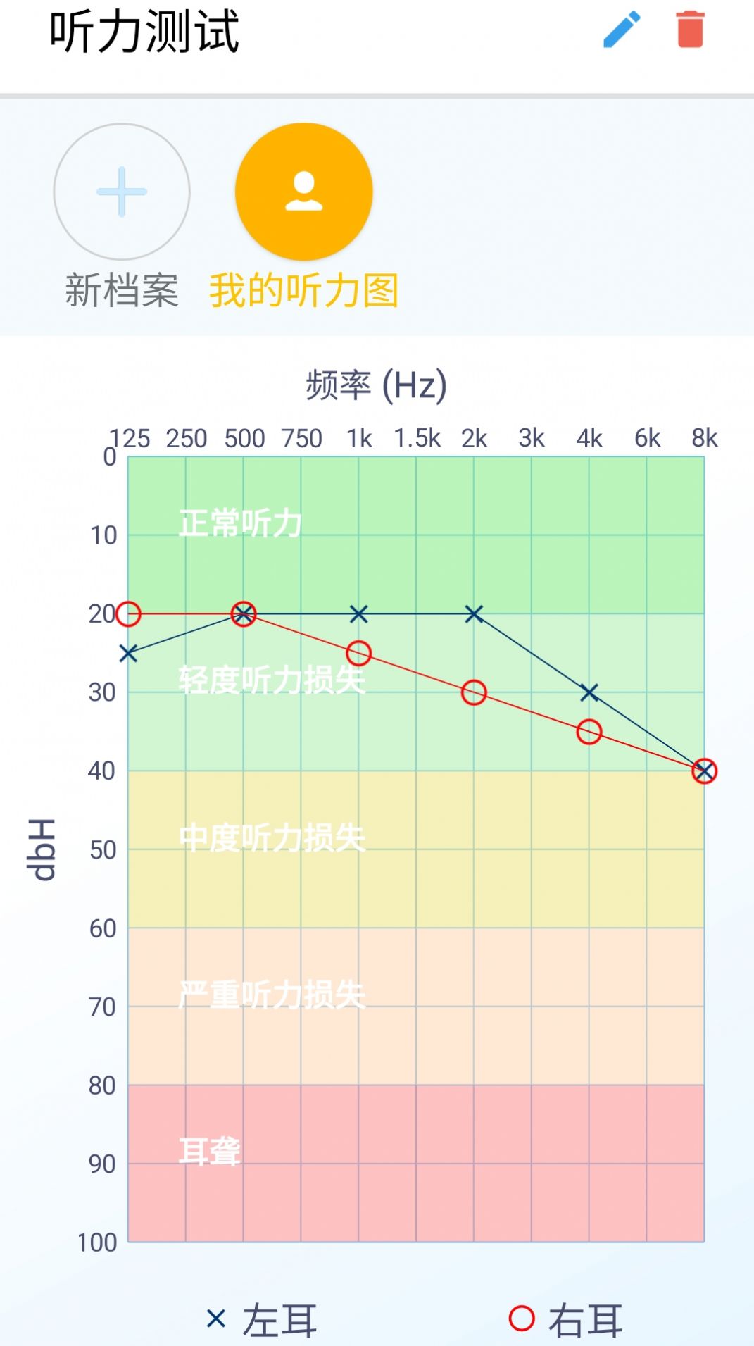 艾米助听app下载-艾米助听app官方版下载v1.0