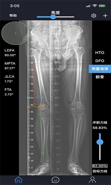 华保膝望官方版手机版下载-华保膝望官方版软件下载v1.7.4